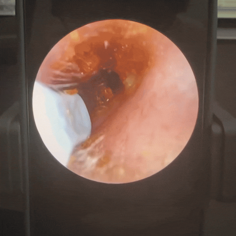 Sanverto VisioEar: tecnologia approvata dai medici per la salute delle tue orecchie